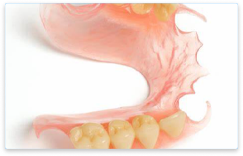 partial dentures services