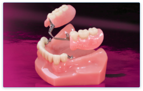 precision dentures